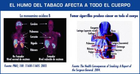 Imagen que muestra los efectos del humo del tabaco en el cuerpo entero